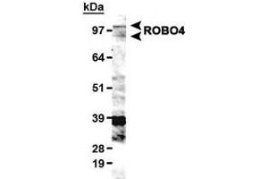 Western blot analysis of ROBO4 in HUVEC lysate with ROBO4 polyclonal antibody . (ROBO4 抗体  (AA 900-1007))
