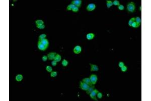 Immunofluorescence staining of PC-3 cells with ABIN7172586 at 1:200, counter-stained with DAPI. (NF-kB p65 抗体  (AA 1-210))