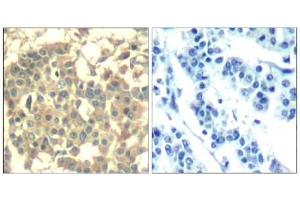 Image no. 2 for anti-Met Proto-Oncogene (MET) (AA 1001-1005) antibody (ABIN401653) (c-MET 抗体  (AA 1001-1005))