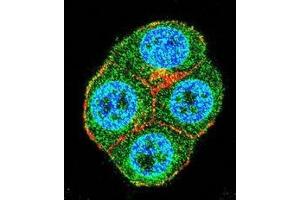 Confocal immunofluorescent analysis of BRTC1 Antibody (N-term)(Cat#AP50409PU-N) with ZR-75-1 cell followed by Alexa Fluor 488-conjugated goat anti-rabbit lgG (green). (BTRC 抗体  (N-Term))