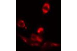 ABIN6272413 staining COLO205 by IF/ICC. (RFX3 抗体  (C-Term))