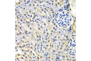Immunohistochemistry of paraffin-embedded mouse kidney using SNRPD2 antibody at dilution of 1:100 (x40 lens). (SNRPD2 抗体)