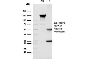 SDS-PAGE Analysis Purified CD40 Ligand Mouse Monoclonal Antibody (CD40LG/2763). (CD40 Ligand 抗体  (AA 108-261))