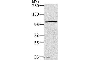 Western blot analysis of K562 cell, using IL17RA Polyclonal Antibody at dilution of 1:200 (IL17RA 抗体)