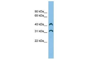 C3orf33 antibody used at 1 ug/ml to detect target protein. (C3orf33 抗体  (Middle Region))
