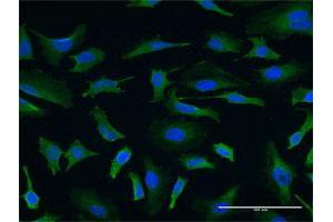Immunofluorescence of monoclonal antibody to USP9X on HeLa cell. (USP9X 抗体  (AA 1-90))