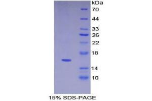SDS-PAGE (SDS) image for Keratin 15 (KRT15) (AA 274-399) protein (His tag) (ABIN1099222)