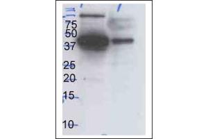 Western Blotting (WB) image for anti-Mitogen-Activated Protein Kinase 1/3 (MAPK1/3) antibody (ABIN371670) (ERK1/2 抗体)