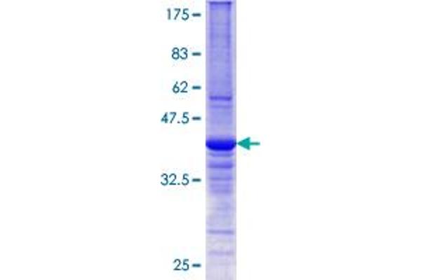 DNAJB6 Protein (AA 72-172) (GST tag)