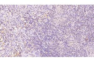 Detection of CD97 in Human Spleen Tissue using Monoclonal Antibody to Cluster Of Differentiation 97 (CD97) (CD97 抗体  (AA 58-260))