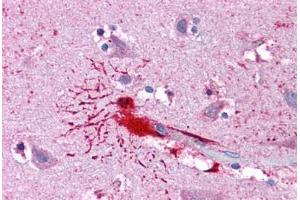 Human Brain, Cortex: Formalin-Fixed, Paraffin-Embedded (FFPE) (LHX8 抗体  (AA 1-321))