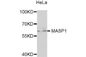 Western blot analysis of extracts of HeLa cells, using MASP1 antibody. (MASP1 抗体)