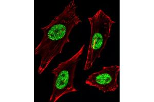 Fluorescent image of Hela cells stained with MGMT Antibody B. (MGMT 抗体)