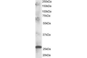 Image no. 1 for anti-ClpP Caseinolytic Peptidase, ATP-Dependent, Proteolytic Subunit Homolog (E. Coli) (CLPP) (C-Term) antibody (ABIN374308) (CLPP 抗体  (C-Term))
