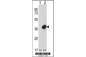 Western Blotting (WB) image for anti-General Transcription Factor IIE, Polypeptide 2 (GTF2E2) (AA 240-269), (C-Term) antibody (ABIN5533296)