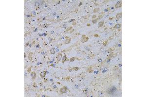 Immunohistochemistry of paraffin-embedded rat brain using GAD2 Antibody (ABIN5970359) at dilution of 1/100 (40x lens). (GAD65 抗体)