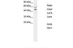 Image no. 2 for anti-GC-Rich Promoter Binding Protein 1 (GPBP1) (AA 67-116) antibody (ABIN6736275) (GC-Rich Promoter Binding Protein 1 (GPBP1) (AA 67-116) 抗体)