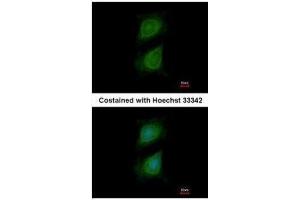 ICC/IF Image Immunofluorescence analysis of methanol-fixed HeLa, using Plexin D1, antibody at 1:500 dilution. (PLXND1 抗体  (C-Term))
