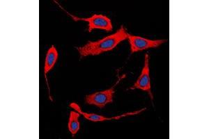 Immunofluorescence (IF) image for anti-Collagen, Type I, alpha 2 (COL1A2) (N-Term) antibody (ABIN7295316)
