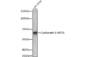 Western blot analysis of extracts of SH-SY5Y cells, using Cytokeratin 9 (KRT9) (KRT9) antibody (ABIN7268107) at 1:1000 dilution. (KRT9 抗体)