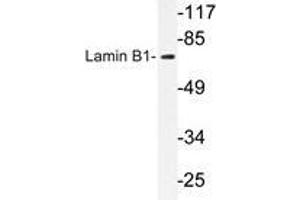 Western blot analysis of Lamin B1 antibody in extracts from COLO cells. (Lamin B1 抗体)