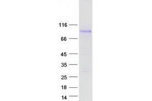 Validation with Western Blot