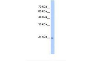 Image no. 1 for anti-Prostaglandin D2 Synthase (PTGDS) (N-Term) antibody (ABIN6738422) (PTGDS 抗体  (N-Term))