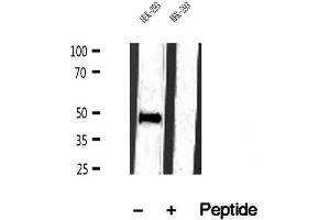 Western blot analysis of extracts of HEK-293 cells, using IFT57 antibody. (IFT57 抗体  (Internal Region))