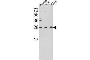 Western blot analysis of TPI1 Antibody (TPI1 抗体  (N-Term))