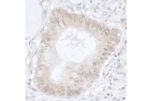 anti-Ubiquitin Specific Peptidase 36 (USP36) (C-Term) antibody