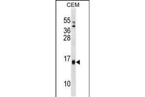 Western blot analysis in CEM cell line lysates (35ug/lane). (SAA4 抗体  (C-Term))