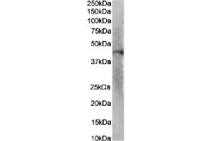 Western Blot using anti-IL-8RA antibody SE2. (Recombinant CXCR2 抗体  (N-Term))