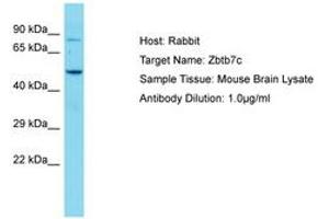 Image no. 1 for anti-Zinc Finger and BTB Domain Containing 7C (ZBTB7C) (AA 181-230) antibody (ABIN6750236) (ZBTB7C 抗体  (AA 181-230))