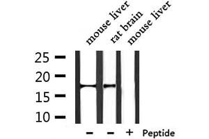 Western blot analysis of extracts from mouse liver ,rat brain, using NDUFA13 Antibody. (NDUFA13 抗体  (N-Term))