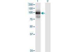 Western Blot analysis of MGC16169 expression in transfected 293T cell line by MGC16169 monoclonal antibody (M01), clone 7A7. (TBCK 抗体  (AA 601-700))