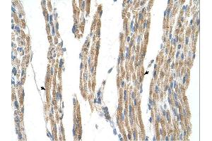 GPT antibody was used for immunohistochemistry at a concentration of 4-8 ug/ml. (ALT 抗体)