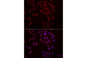 Immunofluorescence analysis of A549 cell using FRZB antibody. (FRZB 抗体)