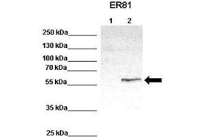 WB Suggested Anti-ETV1 Antibody    Positive Control:  Lane 1: 100ug untransfected HEK293 lysate Lane 2: 33ug ER81 transfected HEK293 lysate   Primary Antibody Dilution :   1:1000  Secondary Antibody :  Anti-rabbit-HRP   Secondry Antibody Dilution :   1:2000  Submitted by:  Anonymous (ETV1 抗体  (Middle Region))