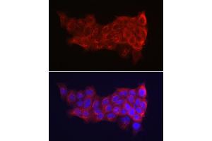 Immunofluorescence analysis of A-431 cells using Cytokeratin 14 (KRT14) Rabbit pAb (ABIN7268092) at dilution of 1:150 (40x lens). (KRT14 抗体  (C-Term))