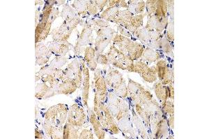 Immunohistochemistry of paraffin-embedded rat heart using MBNL1 antibody. (MBNL1 抗体  (AA 1-382))