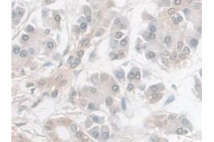 Immunohistochemistry (IHC) image for anti-Enolase 2 (Gamma, Neuronal) (ENO2) (AA 2-285) antibody (ABIN7427918)