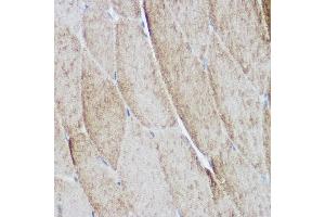 Immunohistochemistry of paraffin-embedded mouse skeletal muscle using  Rabbit pAb (ABIN6127422, ABIN6136487, ABIN6136489 and ABIN6216551) at dilution of 1:500 (40x lens). (ACTN3 抗体  (AA 580-630))