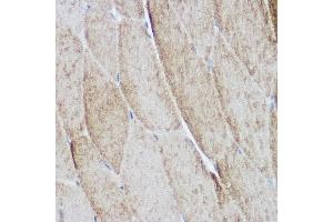 Immunohistochemistry of paraffin-embedded mouse skeletal muscle using  Rabbit pAb (ABIN6127422, ABIN6136487, ABIN6136489 and ABIN6216551) at dilution of 1:500 (40x lens).