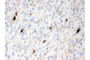 Alpha Internexin was detected in paraffin-embedded sections of human glioma tissues using rabbit anti- Alpha Internexin Antigen Affinity purified polyclonal antibody (Catalog # ) at 1 µg/mL. (INA 抗体  (AA 71-161))