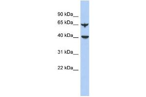 Western Blotting (WB) image for anti-Apolipoprotein B mRNA Editing Enzyme, Catalytic Polypeptide-Like 4 (Putative) (APOBEC4) (N-Term) antibody (ABIN2786461)