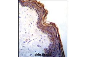 Kallikrein 7(KLK7) Antibody immunohistochemistry analysis in formalin fixed and paraffin embedded human skin tissue followed by peroxidase conjugation of the secondary antibody and DAB staining.