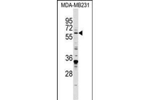 EGR1 Antibody (N-term) (ABIN389442 and ABIN2839514) western blot analysis in MDA-M cell line lysates (35 μg/lane). (EGR1 抗体  (N-Term))