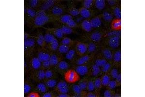 Immunofluorescence staining of methanol-fixed HeLa cells using EIF4G1 polyclonal antibody . (EIF4G1 抗体  (Ser1232))