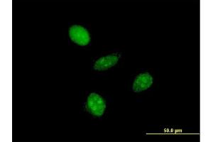Immunofluorescence of monoclonal antibody to GTF2A1L on HeLa cell. (GTF2A1L 抗体  (AA 251-348))
