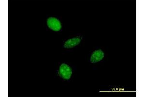 Immunofluorescence of monoclonal antibody to GTF2A1L on HeLa cell.